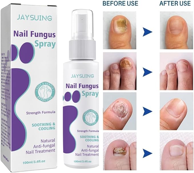 Gentle Nail Fungus Remover - Emirex