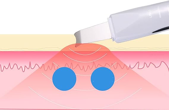 Face Blackhead Remover - Emirex