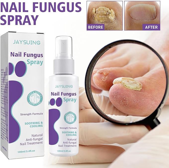 Gentle Nail Fungus Remover - Emirex