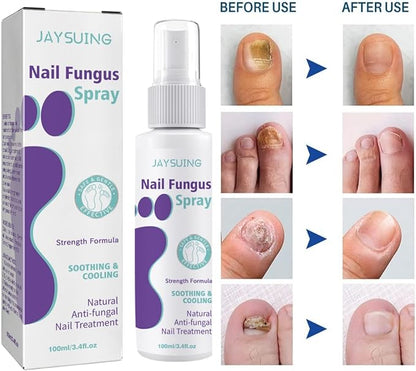Gentle Nail Fungus Remover - Emirex