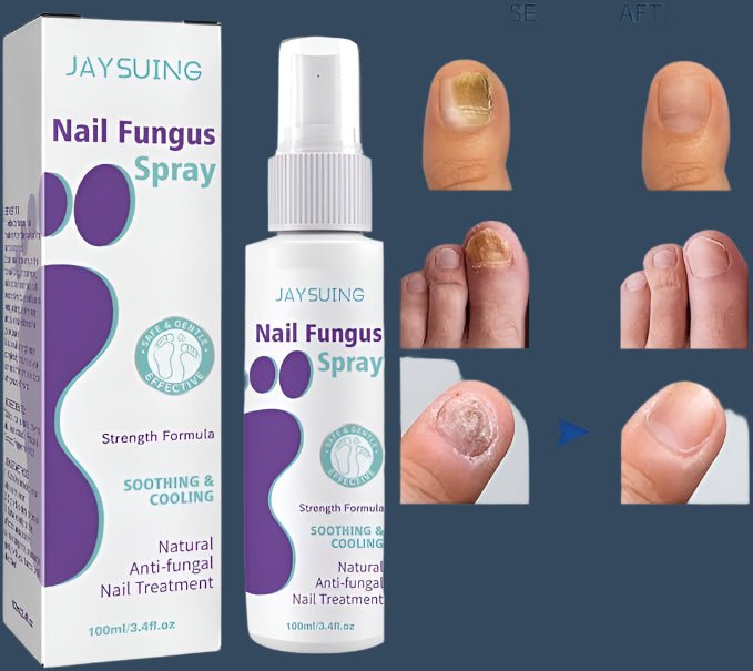 Gentle Nail Fungus Remover - Emirex