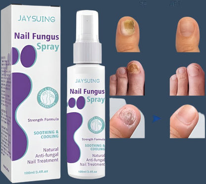 Gentle Nail Fungus Remover - Emirex