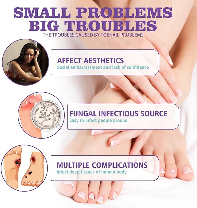 Nail Fungus Spray - Emirex