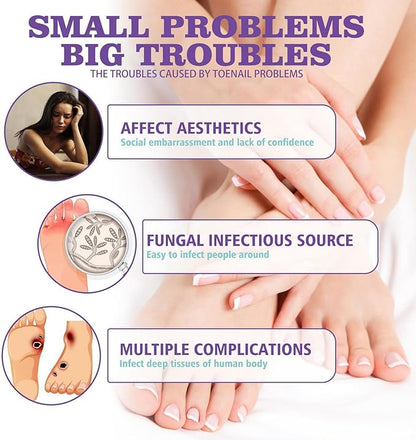 Nail Fungus Spray - Emirex