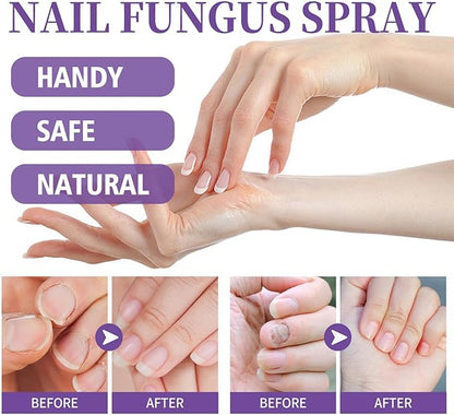 Nail Fungus Spray - Emirex
