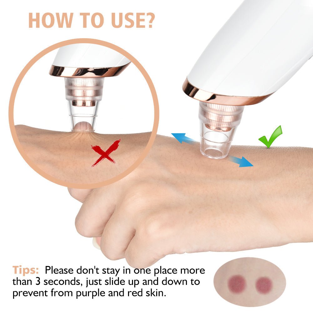 Pore Cleaning Device - Emirex