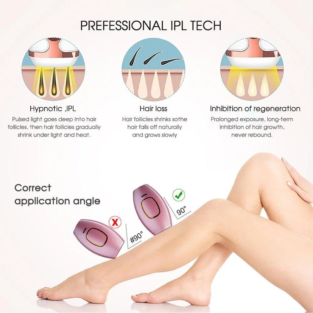 Vyke™ IPL Hair Remover - Emirex